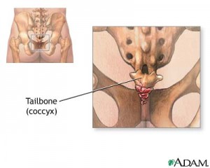 Taibone Pain (Coccydynia)