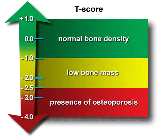 T-Scores for Osteoporosis