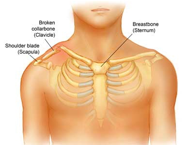 Steroid injections in back